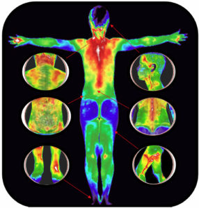 Benefit - Screening - Thermal Imaging Texas - Angel Marlow - Houston, TX