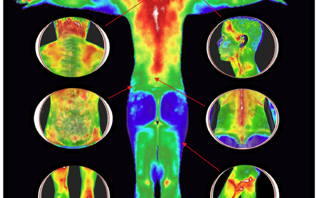 Who does Thermography Benefit?
