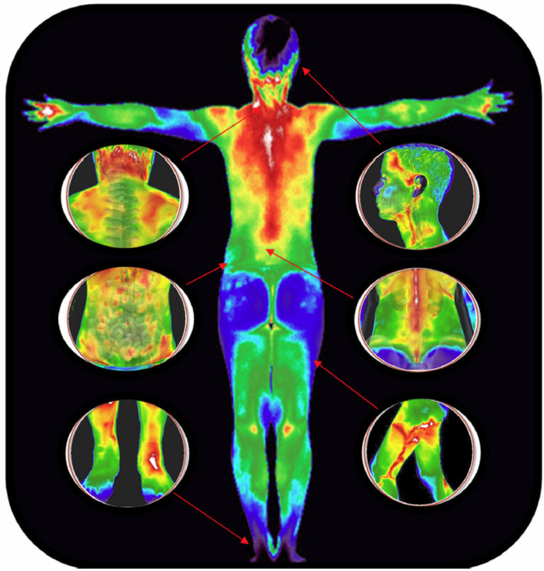 Who Does Thermography Benefit - Thermal Imaging Texas - Angel Marlow